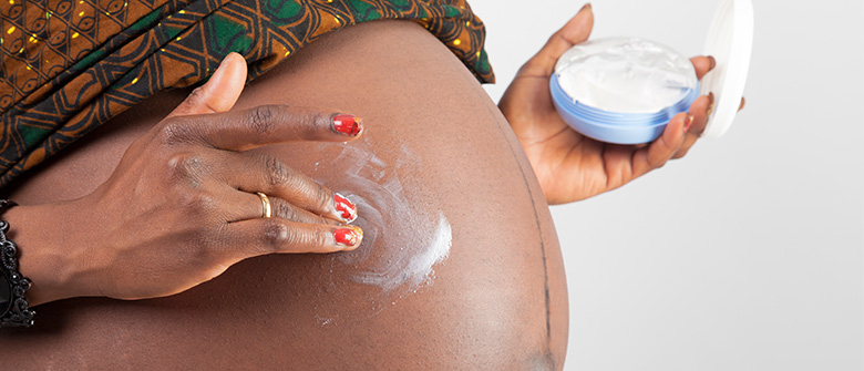 stretch marks remedy