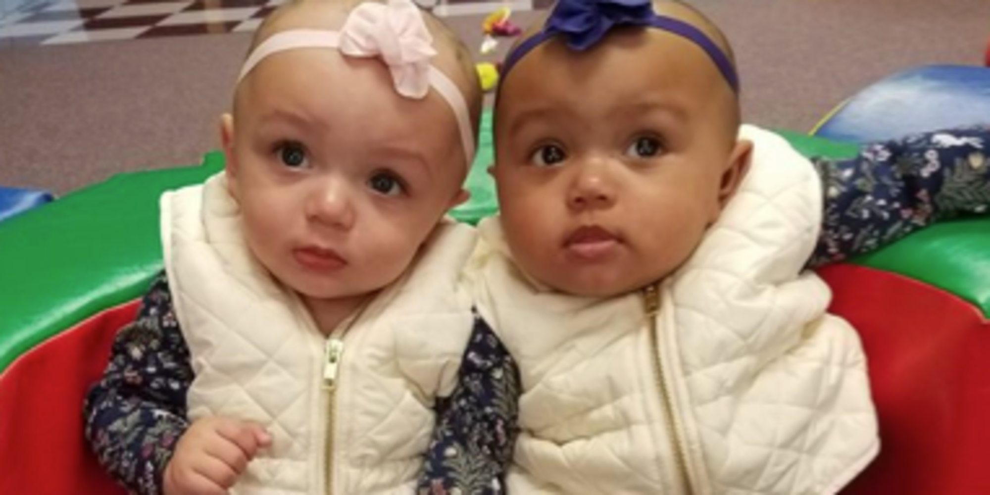 These Adorable Twins Were Born With Two Different Skin Colors BabiesMata