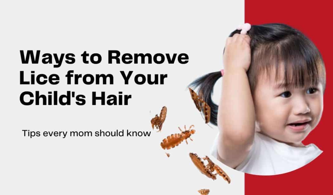Ways to Remove Lice from Your Child's Hair Babiesmata