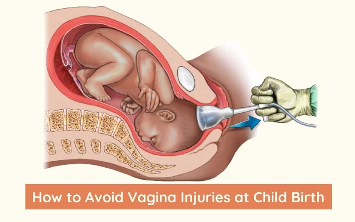 Vaginal Injury